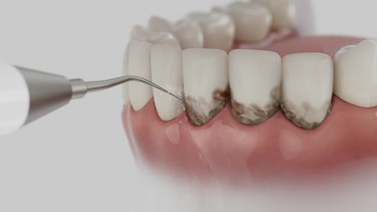 Reliable Dental contractor in Parkland, WA by Dentist Open Now